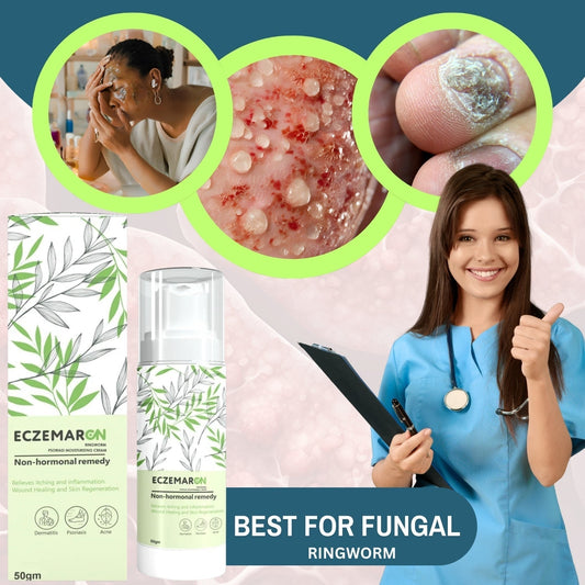 Eczemaron Anti-Fungal Cream: A Solution for Skin Conditions