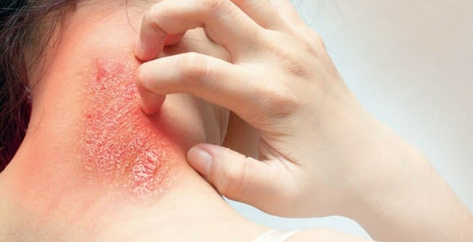 Treatment And Care For Fungal Infections In Changing Season