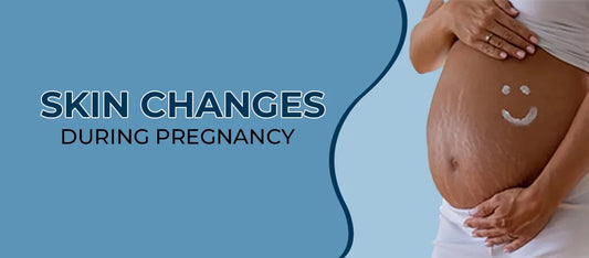 How you can deal with these Stretch Marks During and After Pregnancy