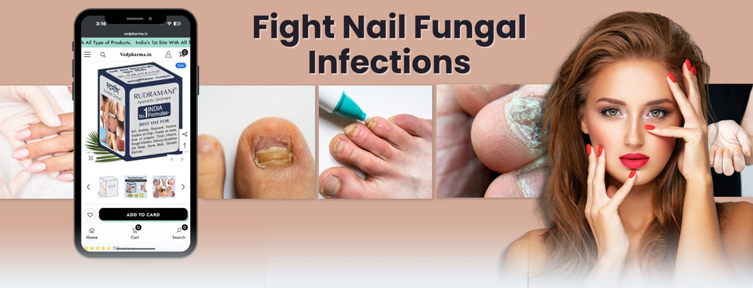 Nail Fungal Cream
