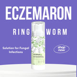 Eczemaron ringworm anti fungal cream (50gm)