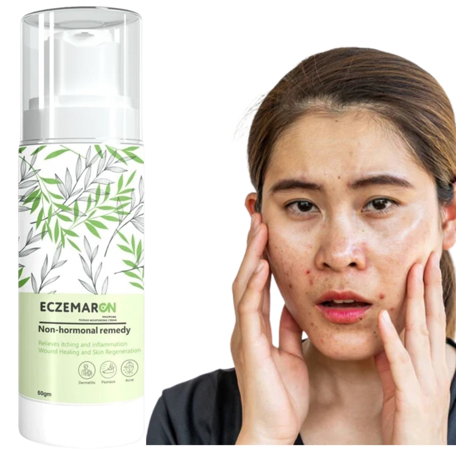 Eczemaron ringworm anti fungal cream (50gm)