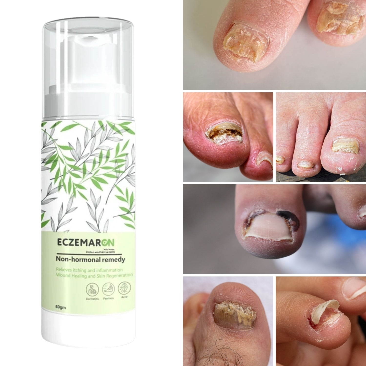 Eczemaron ringworm anti fungal cream (50gm)