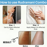 RUDRAMANI Ayurvedic Skin Care Combo – Herbal Ointment + Skin Lightening Soap for Glowing Skin, Pimples, Eczema, Scars, Fungal Infections & Oil Control – Natural Face & Body Care
