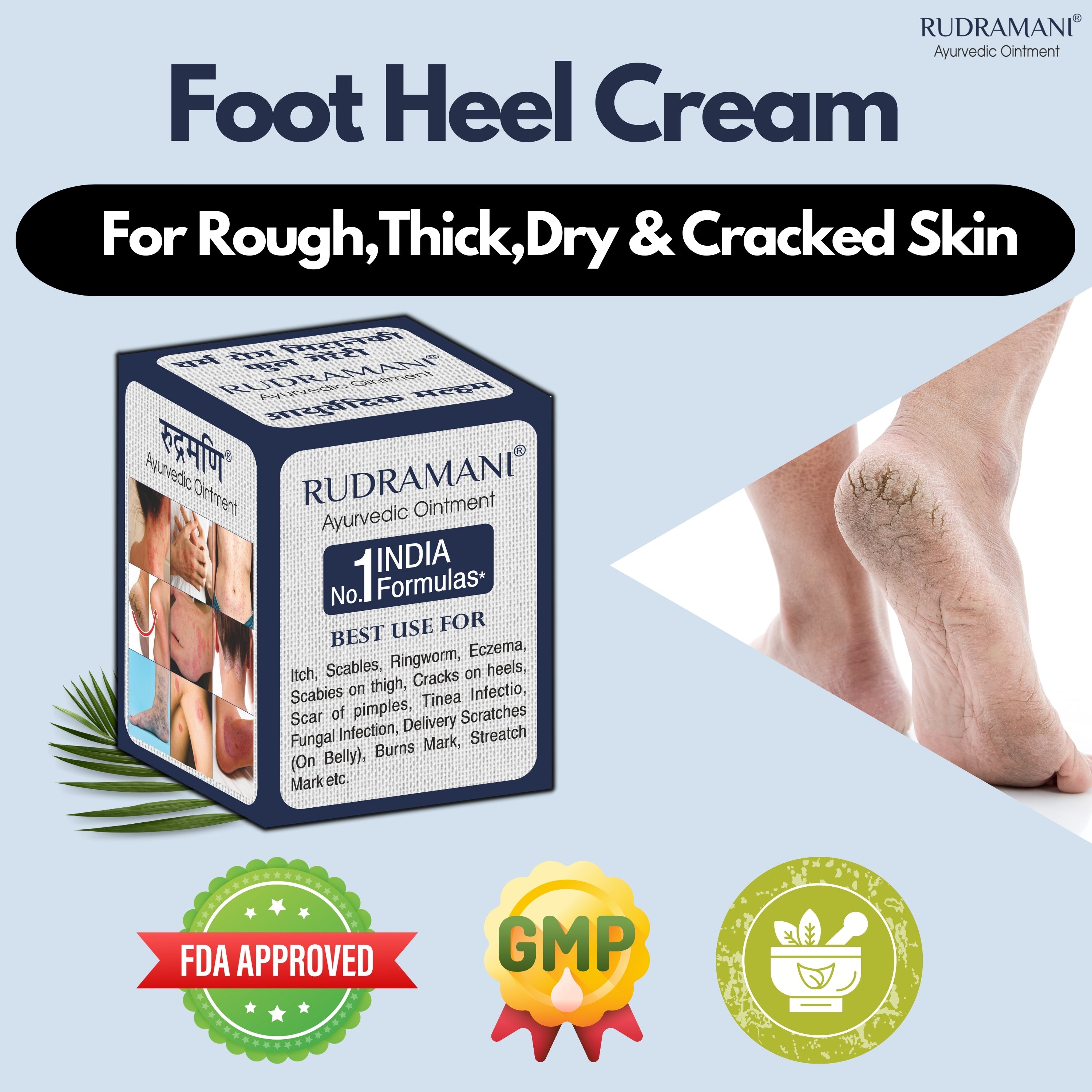 Rudramani Ayurvedic Malam (Cream) for Anti-Fungal Infection, Itching & Skin Recovery for All Skin Types 25gm