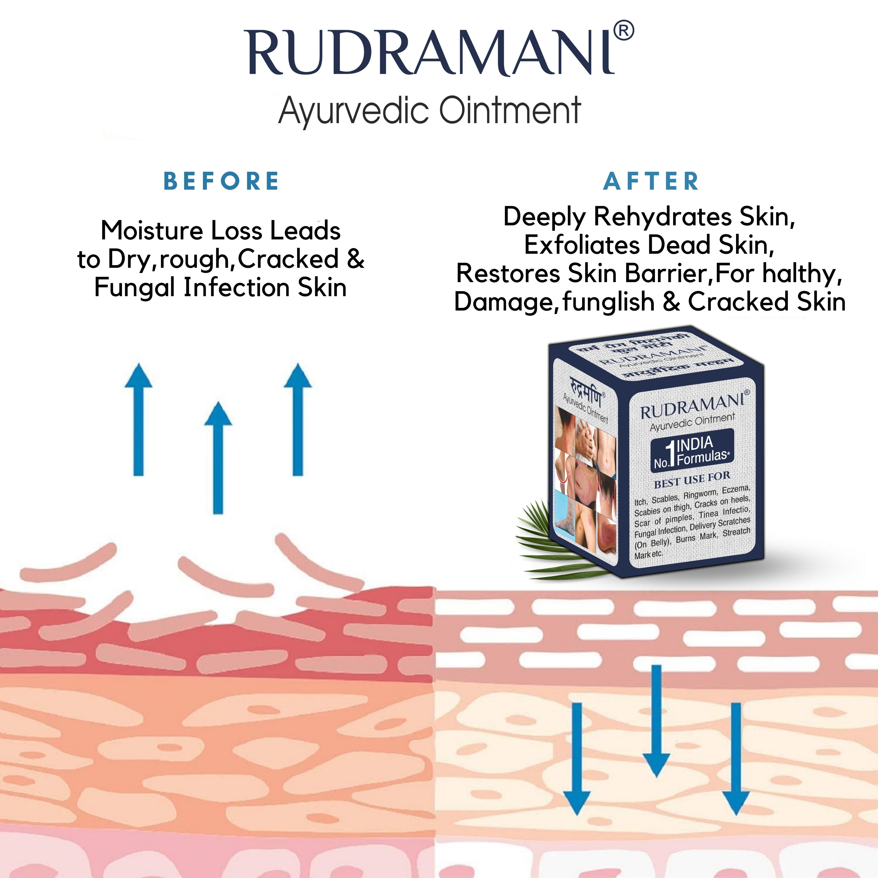 Rudramani Ayurvedic Malam (Cream) for Anti-Fungal Infection, Itching & Skin Recovery for All Skin Types 25gm
