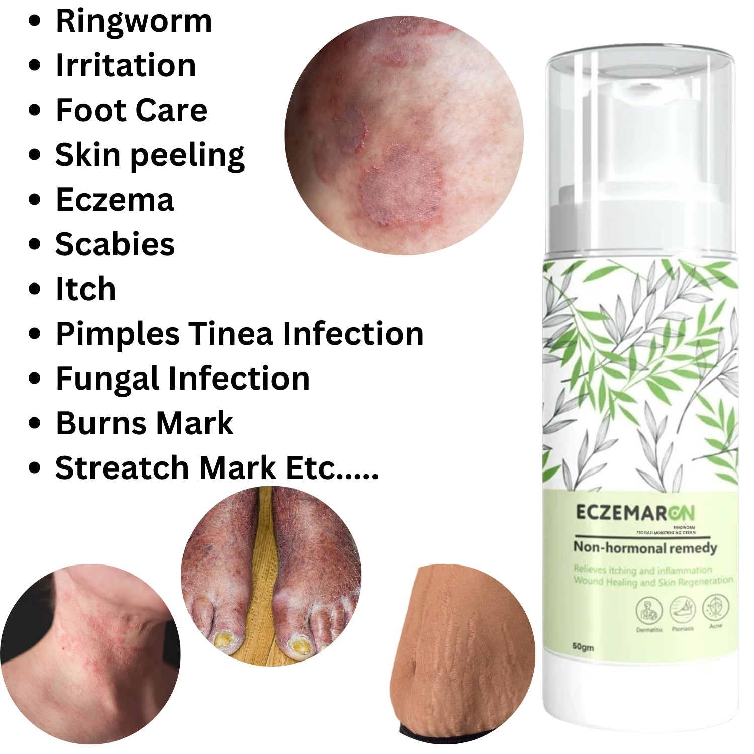 Eczemaron ringworm anti fungal cream (50gm)